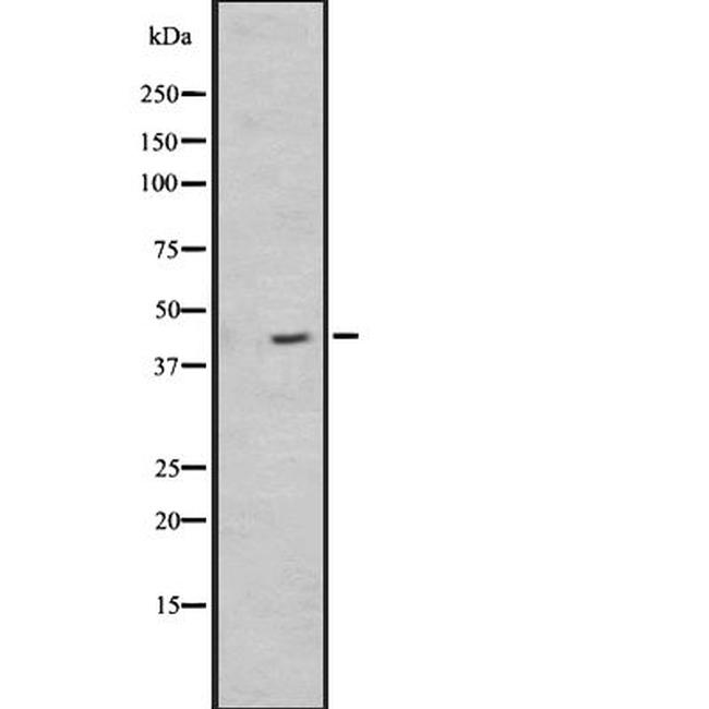 NPSR1 Antibody in Western Blot (WB)