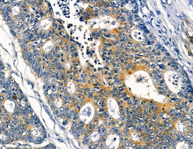 NPY4R Antibody in Immunohistochemistry (Paraffin) (IHC (P))