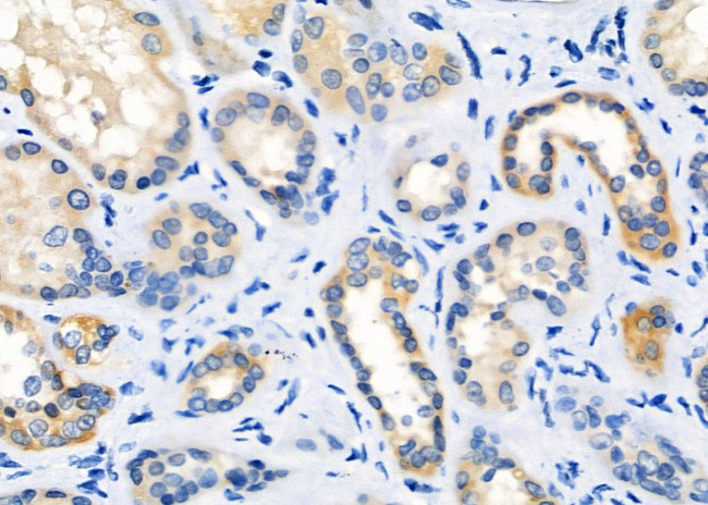 OR2T8/OR2T12/OR2T33 Antibody in Immunohistochemistry (Paraffin) (IHC (P))