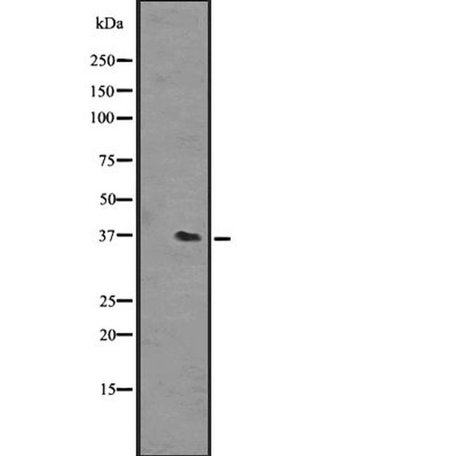 OR51L1 Antibody in Western Blot (WB)