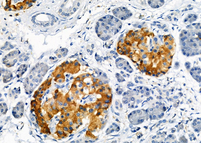 OR5AN1 Antibody in Immunohistochemistry (Paraffin) (IHC (P))