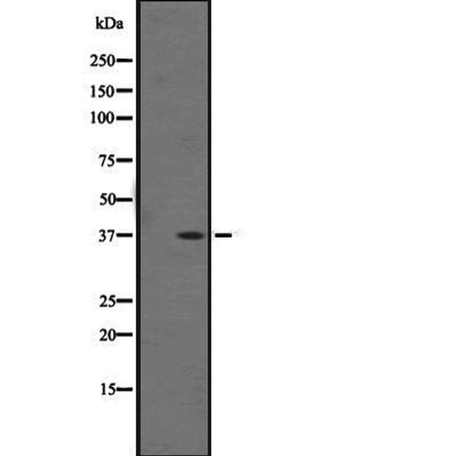 OR1F1 Antibody in Western Blot (WB)