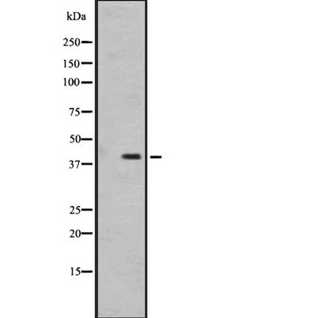 OR1I1 Antibody in Western Blot (WB)