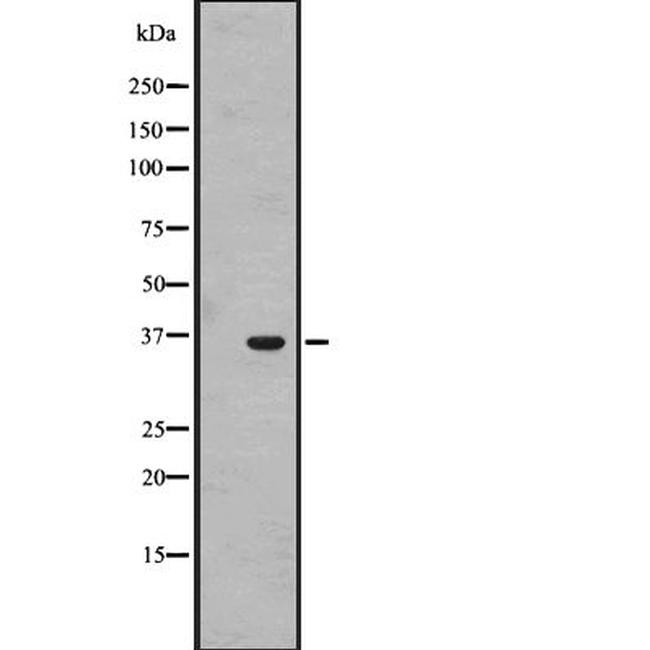 OR1J4 Antibody in Western Blot (WB)