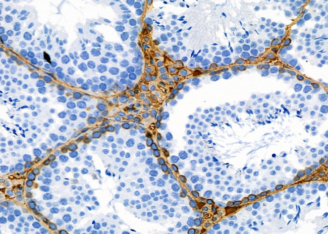 OR1J2/OR1N2 Antibody in Immunohistochemistry (Paraffin) (IHC (P))