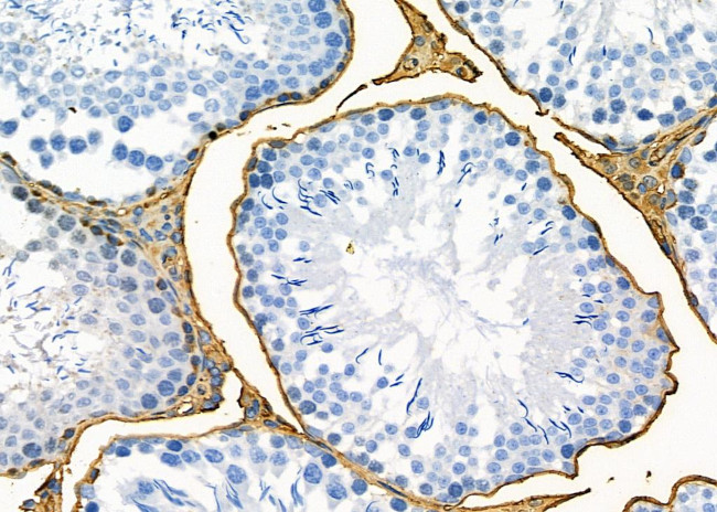 OR1J2/OR1N2 Antibody in Immunohistochemistry (Paraffin) (IHC (P))