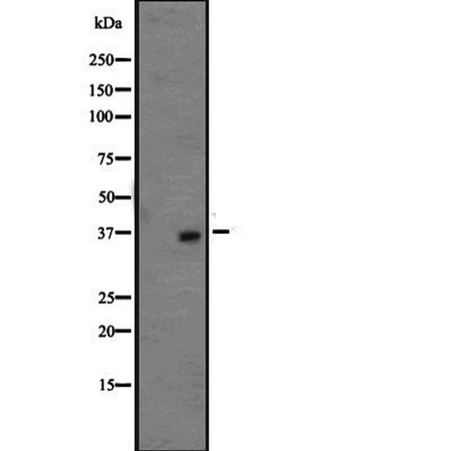 OR1L3 Antibody in Western Blot (WB)