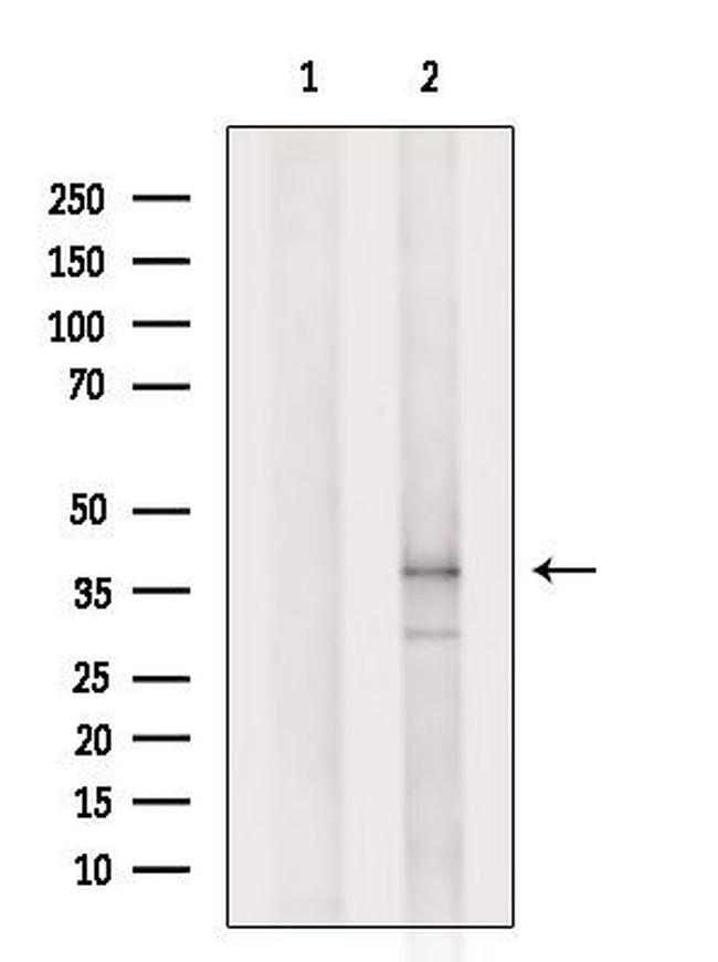 OR2A2 Antibody in Western Blot (WB)