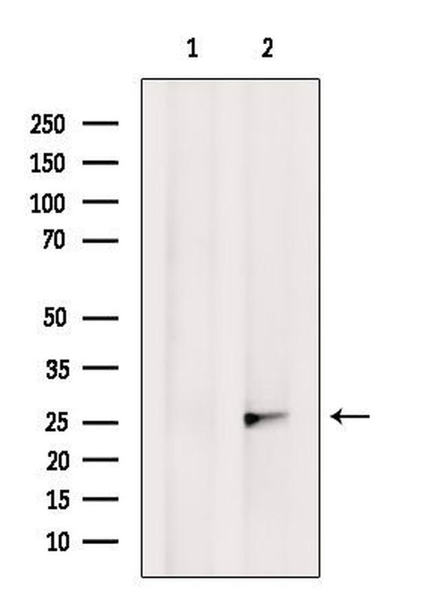 OR2M4 Antibody in Western Blot (WB)