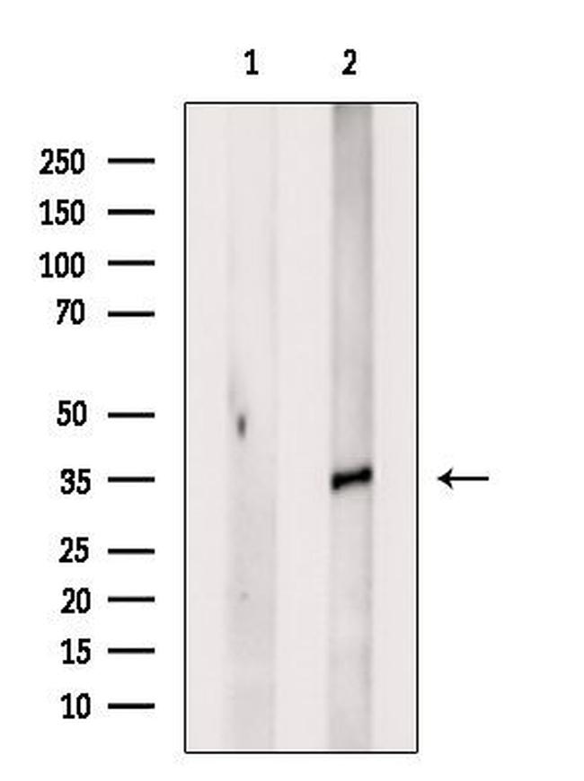 OR2M4 Antibody in Western Blot (WB)