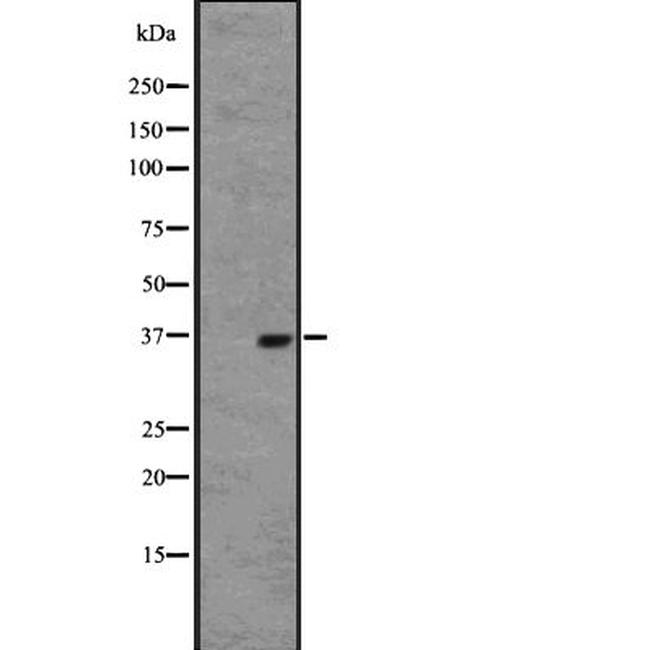 OR2W1 Antibody in Western Blot (WB)