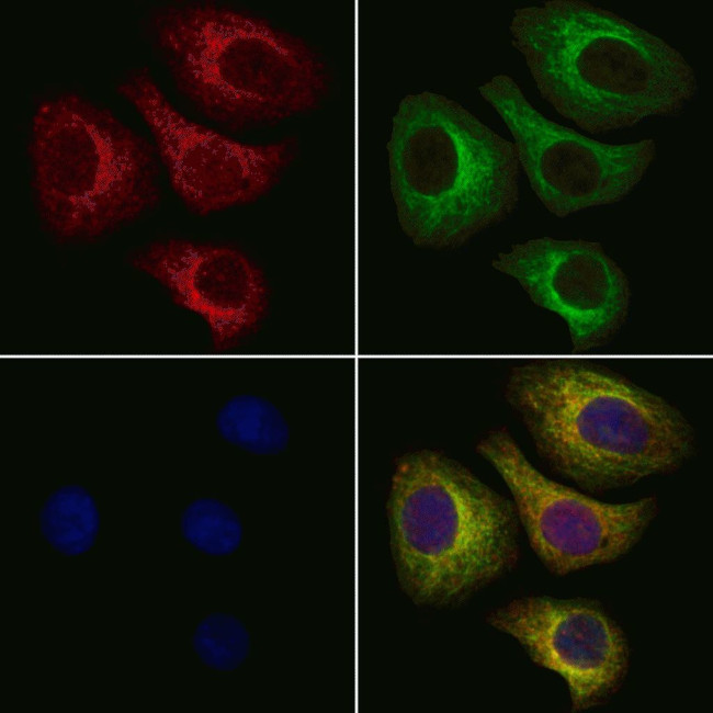 ALAS1 Antibody in Immunocytochemistry (ICC/IF)