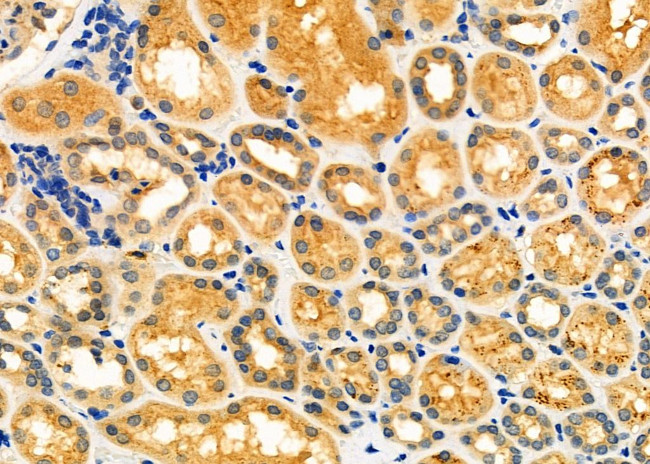 ALAS1 Antibody in Immunohistochemistry (Paraffin) (IHC (P))