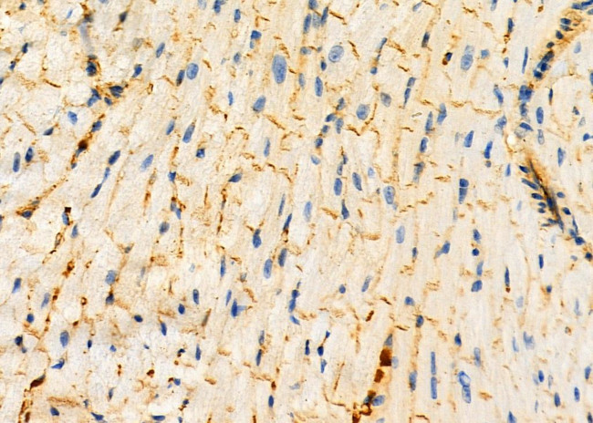 ALAS1 Antibody in Immunohistochemistry (Paraffin) (IHC (P))