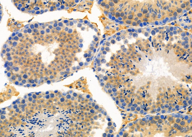 ALAS1 Antibody in Immunohistochemistry (Paraffin) (IHC (P))