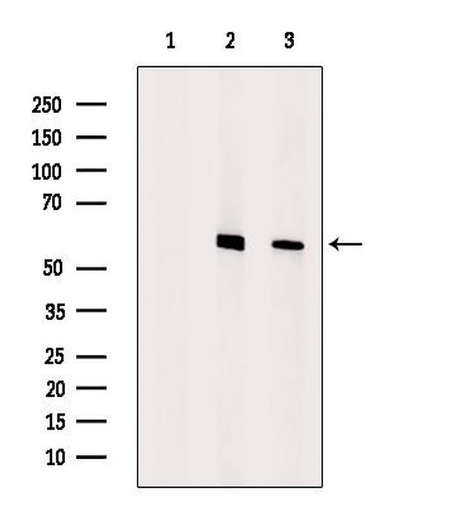 ALAS1 Antibody in Western Blot (WB)