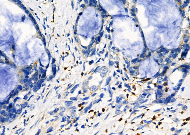 beta Tubulin Antibody in Immunohistochemistry (Paraffin) (IHC (P))