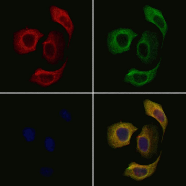 beta Tubulin Antibody in Immunocytochemistry (ICC/IF)