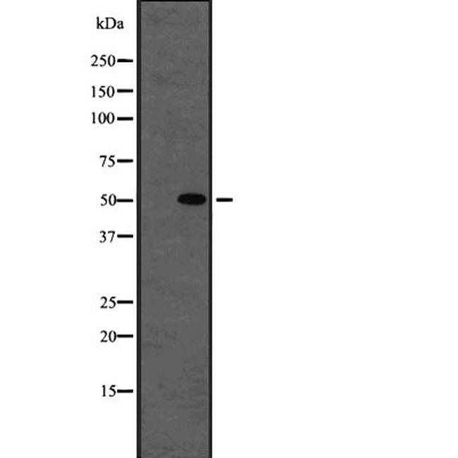 beta Tubulin Antibody in Western Blot (WB)