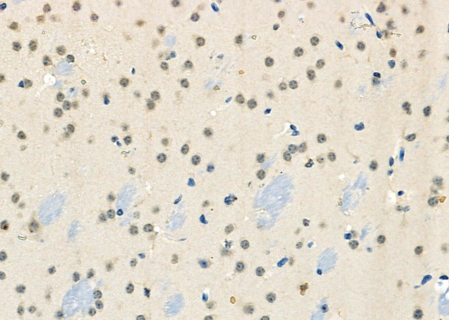 BRD4 Antibody in Immunohistochemistry (Paraffin) (IHC (P))