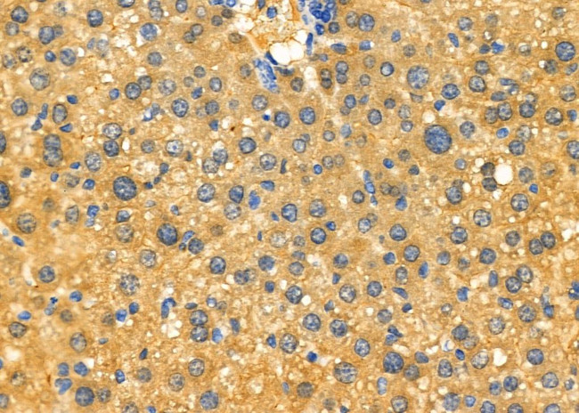 Enkurin Antibody in Immunohistochemistry (Paraffin) (IHC (P))