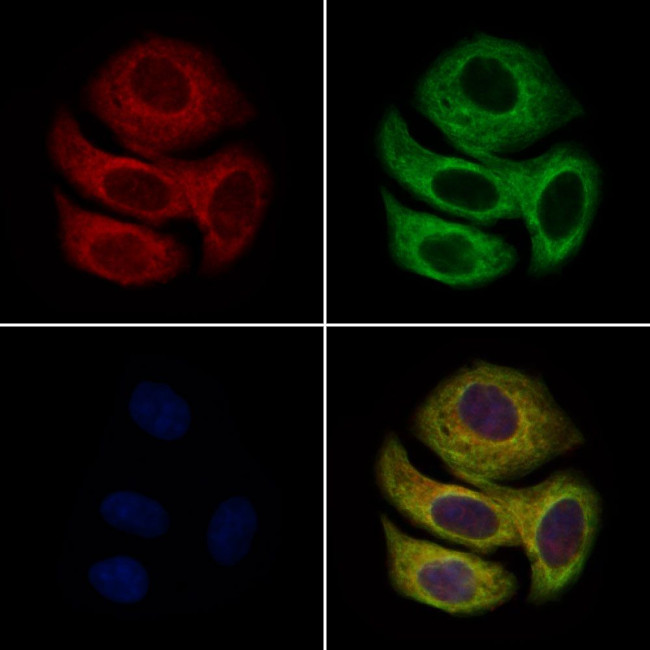 Enkurin Antibody in Immunocytochemistry (ICC/IF)