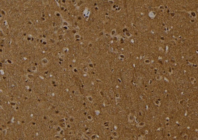 H2AK9ac Antibody in Immunohistochemistry (Paraffin) (IHC (P))