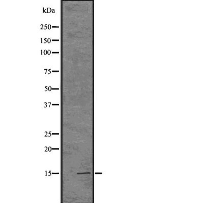 H3K14me1me2me3 Antibody in Western Blot (WB)