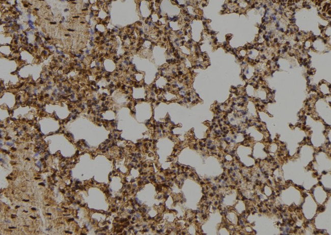 ID1 Antibody in Immunohistochemistry (Paraffin) (IHC (P))