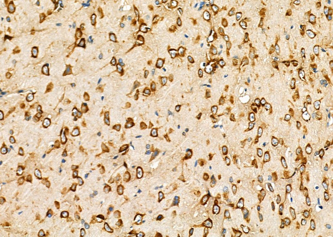 KDEL Receptor Pan Antibody in Immunohistochemistry (Paraffin) (IHC (P))