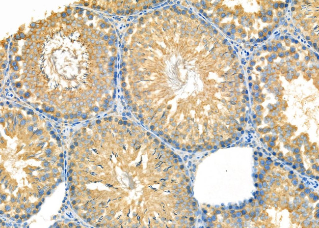 KDEL Receptor Pan Antibody in Immunohistochemistry (Paraffin) (IHC (P))