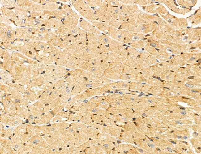 LRP1 Antibody in Immunohistochemistry (Paraffin) (IHC (P))