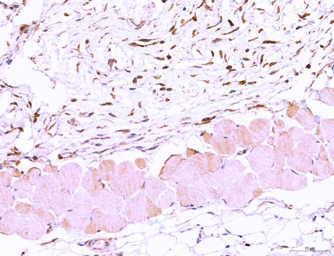 LRP1 Antibody in Immunohistochemistry (Paraffin) (IHC (P))