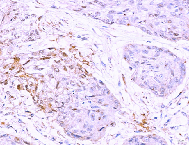 LRP1 Antibody in Immunohistochemistry (Paraffin) (IHC (P))