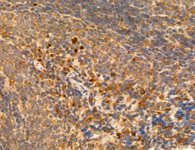 LRP1 Antibody in Immunohistochemistry (Paraffin) (IHC (P))