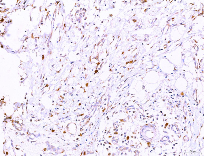 LRP1 Antibody in Immunohistochemistry (Paraffin) (IHC (P))