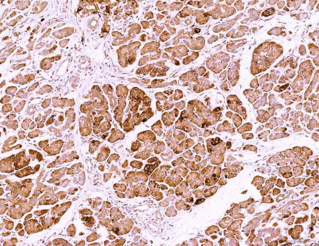 LRP1 Antibody in Immunohistochemistry (Paraffin) (IHC (P))