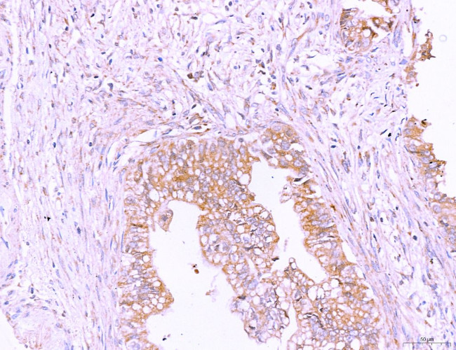 LRP1 Antibody in Immunohistochemistry (Paraffin) (IHC (P))