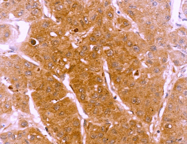 LRP1 Antibody in Immunohistochemistry (Paraffin) (IHC (P))