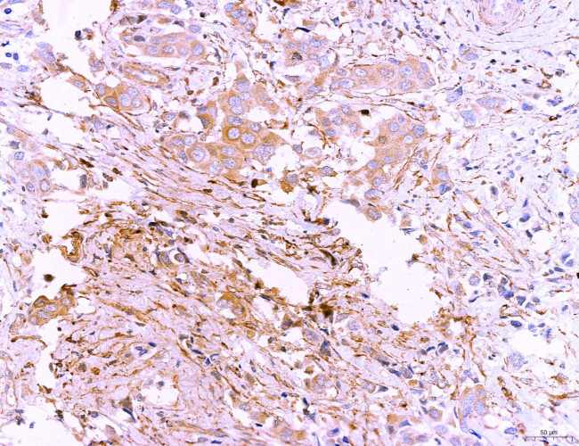 LRP1 Antibody in Immunohistochemistry (Paraffin) (IHC (P))