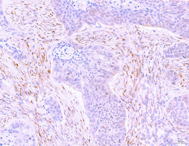 LRP1 Antibody in Immunohistochemistry (Paraffin) (IHC (P))