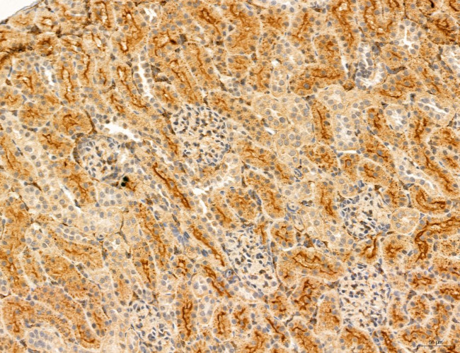 LRP1 Antibody in Immunohistochemistry (Paraffin) (IHC (P))