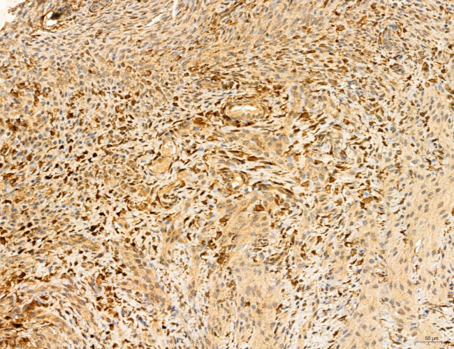 LRP1 Antibody in Immunohistochemistry (Paraffin) (IHC (P))