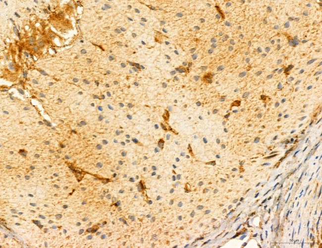 LRP1 Antibody in Immunohistochemistry (Paraffin) (IHC (P))