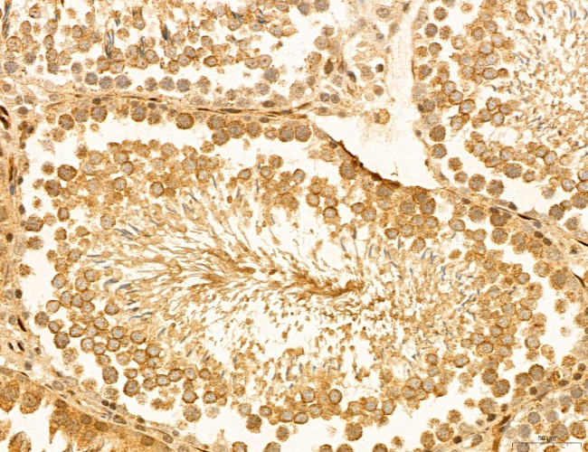 LRP1 Antibody in Immunohistochemistry (Paraffin) (IHC (P))