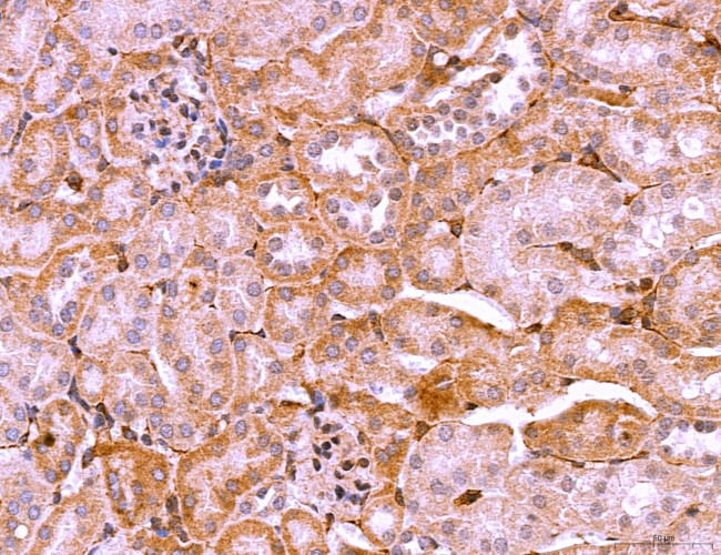 LRP1 Antibody in Immunohistochemistry (Paraffin) (IHC (P))