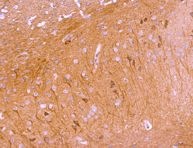 LRP1 Antibody in Immunohistochemistry (Paraffin) (IHC (P))