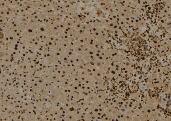 Myb Antibody in Immunohistochemistry (Paraffin) (IHC (P))