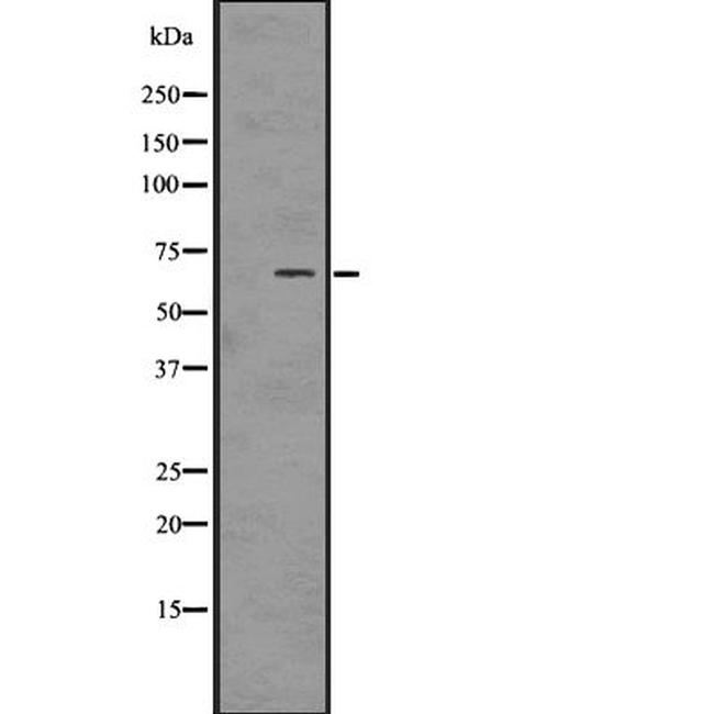 Phospho-PAK1/2/3 (Ser144, Ser141, Ser139) Antibody in Western Blot (WB)