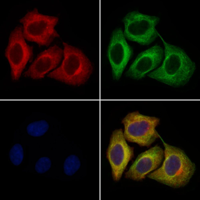 PMEL Antibody in Immunocytochemistry (ICC/IF)